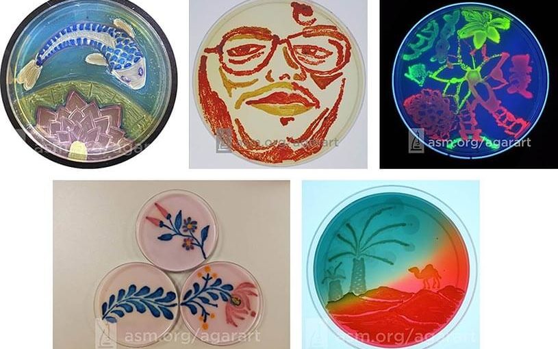 Microbiology agar art competition