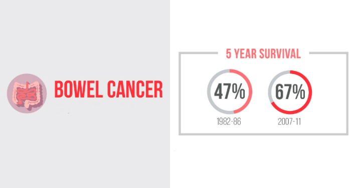 “A simple test can save your life”: bowel cancer still second biggest cancer killer