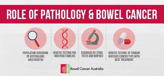 Poor awareness of bowel cancer screening a worrying risk to Australian adults