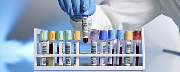 What do the most common pathology tests look for?