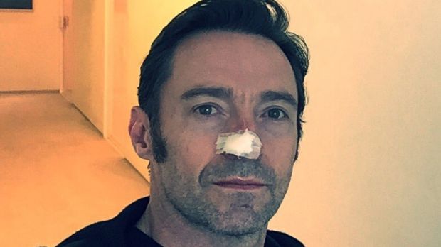 Not just a pretty face: Hugh Jackman’s photo tells of skin cancer danger